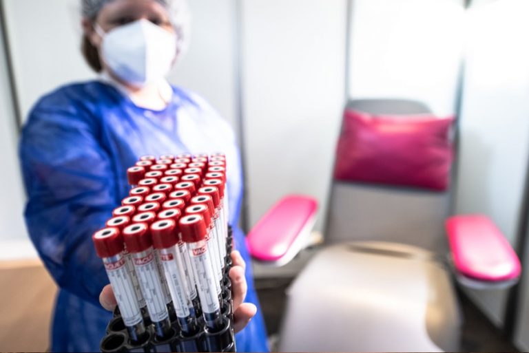 Centre de dépistage à l’espace Léo Ferré : qui peut se faire tester, et quand ?