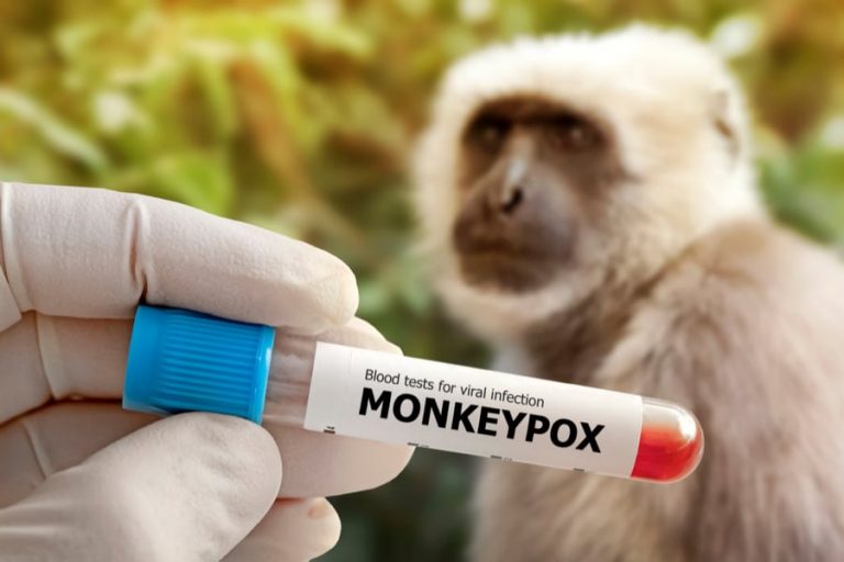 Variole du singe : un premier cas détecté à Monaco